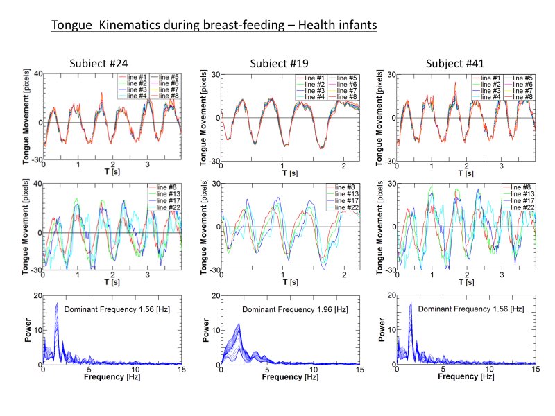 Tongue-Kinematics-2
